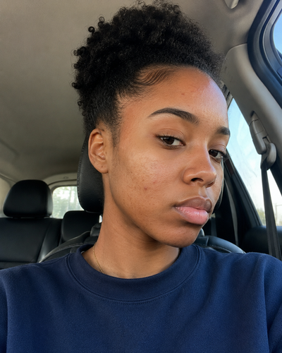 Before - Emily T.
